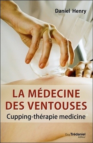 La médecine des ventouses - Cupping-thérapie medicine 